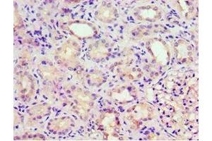 Immunohistochemistry of paraffin-embedded human kidney tissue using ABIN7153302 at dilution of 1:100 (GRK6 抗体  (AA 1-170))