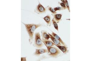 Anti-Kallikrein 6 antibody, ICC ICC: PC-3 Cell (Kallikrein 6 抗体  (C-Term))