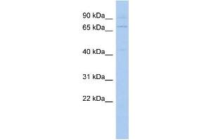 WB Suggested Anti-KLHL3 Antibody Titration: 0. (KLHL3 抗体  (N-Term))