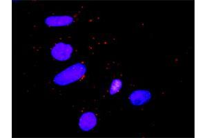 Proximity Ligation Assay (PLA) image for anti-Signal Transducer and Activator of Transcription 5B (STAT5B) (AA 1-390) antibody (ABIN520545)