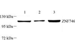 Western blot analysis of PARIS (ABIN7076272) at dilution of 1: 1000,Lane 1: THP-1 cell lysate,Lane 2: SH-SY5Y cell lysate,Lane 3: U251 cell lysate (ZNF746 抗体)