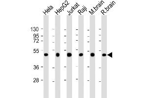 Western Blot at 1:2000 dilution Lane 1: Hela whole cell lysate Lane 2: HepG2 whole cell lysate Lane 3: Jurkat whole cell lysate Lane 4: Raji whole cell lysate Lane 5: mouse brain lysate Lane 6: rat brain lysate Lysates/proteins at 20 ug per lane. (CTBP1 抗体  (C-Term))