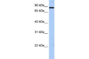 WB Suggested Anti-TMTC1 Antibody Titration:  0. (TMTC1 抗体  (Middle Region))