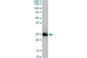 HMGB2 monoclonal antibody (M02), clone 4G7. (HMGB2 抗体  (AA 1-195))