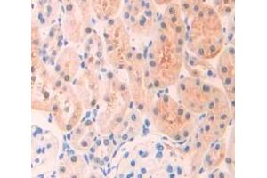 Immunohistochemistry (IHC) image for anti-Insulin-Like Growth Factor Binding Protein 6 (IGFBP6) (AA 51-226) antibody (ABIN1859311)