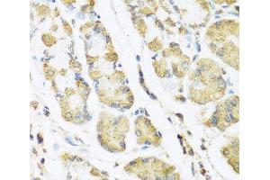 Immunohistochemistry of paraffin-embedded Human stomach using MLN Polyclonal Antibody at dilution of 1:100 (40x lens). (Motilin 抗体)