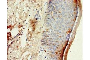 Immunohistochemistry of paraffin-embedded human skin tissue using ABIN7149004 at dilution of 1:100 (CST6 抗体  (AA 29-149))