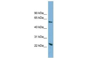 TMEM161A antibody used at 1 ug/ml to detect target protein. (TMEM161A 抗体  (Middle Region))