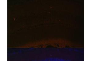 Immunofluorescence analysis of Mouse retina using RDH5 Polyclonal Antibody at dilution of 1:100 (40x lens). (RDH5 抗体)