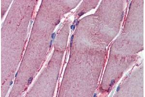 Human Skeletal Muscle: Formalin-Fixed, Paraffin-Embedded (FFPE) (GSTM2 抗体  (AA 90-190))