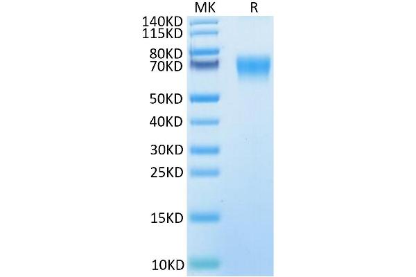 IL18BP Protein (AA 31-194) (Fc Tag)