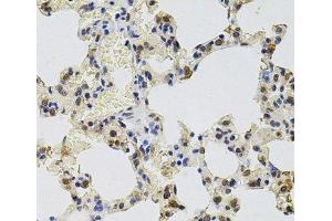 Immunohistochemistry of paraffin-embedded Rat lung using GTF2H2 Polyclonal Antibody at dilution of 1:100 (40x lens). (GTF2H2 抗体)