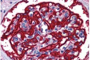Human Kidney: Formalin-Fixed, Paraffin-Embedded (FFPE) (FTH1 抗体  (AA 110-159))