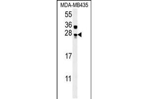 Western blot analysis in MDA-MB435 cell line lysates (15ug/lane). (MUTED 抗体  (AA 40-68))