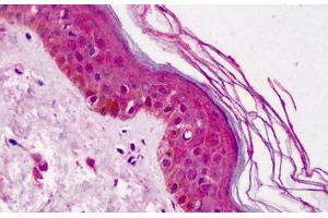 Human Skin: Formalin-Fixed, Paraffin-Embedded (FFPE)