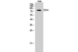 Western Blotting (WB) image for anti-CD44 (CD44) (Ser2152) antibody (ABIN3183773) (CD44 抗体  (Ser2152))