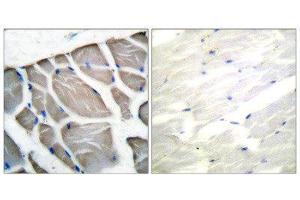Immunohistochemistry (IHC) image for anti-Actin (pan) antibody (ABIN1848426) (Actin 抗体  (pan))