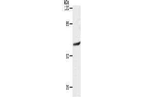 Western Blotting (WB) image for anti-Solute Carrier Family 16 (Monocarboxylic Acid Transporters), Member 4 (SLC16A4) antibody (ABIN7192403)
