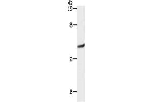 Gel: 10 % SDS-PAGE, Lysate: 40 μg, Lane: 231 cells, Primary antibody: ABIN7192403(SLC16A4 Antibody) at dilution 1/1200, Secondary antibody: Goat anti rabbit IgG at 1/8000 dilution, Exposure time: 10 seconds (SLC16A4 抗体)