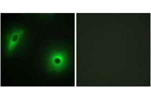 Immunofluorescence analysis of HeLa cells, using 14-3-3 eta Antibody. (14-3-3 eta 抗体  (AA 51-100))