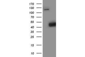 Western Blotting (WB) image for anti-Spermine Synthase, SMS (SMS) antibody (ABIN1501099) (SMS 抗体)