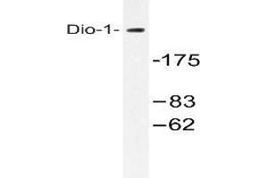 Western blot (WB) analysis with extracts from 293 cells using DIDO1 /  Dio-1 antibody . (DIDO1 抗体)