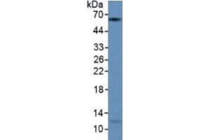 Rabbit Detection antibody from the kit in WB with Positive Control: Human lung lysate. (KRT9 ELISA 试剂盒)
