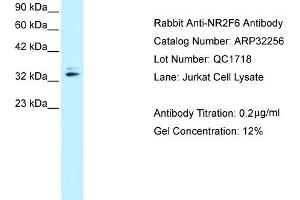Western Blotting (WB) image for anti-Nuclear Receptor Subfamily 2, Group F, Member 6 (NR2F6) (N-Term) antibody (ABIN2779525) (NR2F6 抗体  (N-Term))