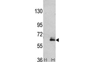 Western blot analysis of anti-MAP2 antibody and 293 cell lysate (2 ug/lane) either nontransfected (Lane 1) or transiently transfected with the hMAP2-Q425 gene (2). (MAP2 抗体  (AA 1766-1796))