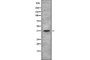 Western blot analysis of TAS2R using 293 whole cell lysates (TBXA2R 抗体  (C-Term))