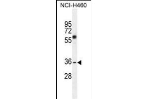C10orf72 Antibody (Center) (ABIN655143 and ABIN2844765) western blot analysis in NCI- cell line lysates (35 μg/lane). (VSTM4 抗体  (AA 142-170))