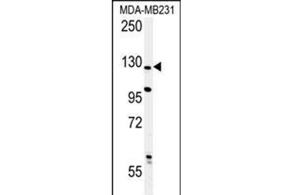 PHLPP2 抗体  (C-Term)