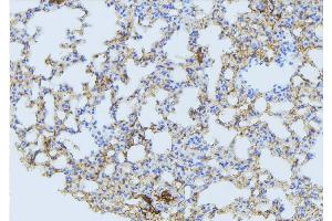 ABIN6275088 at 1/100 staining Mouse lung tissue by IHC-P. (MARCH3 抗体  (Internal Region))