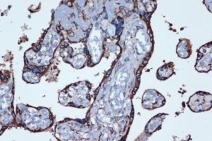 Immunohistochemistry (IHC) image for anti-Prostaglandin E Receptor 2 (Subtype EP2), 53kDa (PTGER2) antibody (ABIN7269572)