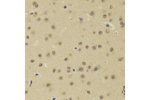 Immunohistochemistry of paraffin-embedded Rat brain using DNTT antibody at dilution of 1:100 (x400 lens). (TdT 抗体)
