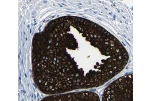 mTOR Antibody for IHC in human prostate tissue (MTOR 抗体)