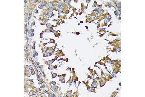 Immunohistochemistry of paraffin-embedded rat testis using LysRS/KARS Rabbit mAb (ABIN7268350) at dilution of 1:100 (40x lens). (KARS 抗体)