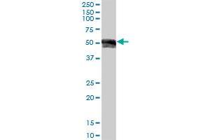 Western Blotting (WB) image for anti-Immunoglobulin Heavy Constant gamma 1 (G1m Marker) (IGHG1) (AA 1-469) antibody (ABIN516955)