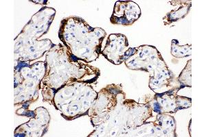 Anti-Annexin A1 antibody, IHC(P) IHC(P): Human Placenta Tissue (Annexin a1 抗体  (N-Term))