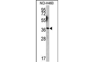 Western blot analysis of EN2 antibody (C-term-2) in NCI-H460 cell line lysates (35ug/lane)