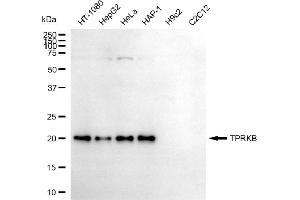 Western blotting analysis using TPRKB antibody (ABIN7800578).