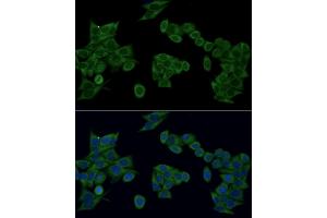 Immunofluorescence analysis of HeLa cells using IRF3 antibody (ABIN6128099, ABIN6142528, ABIN6142531 and ABIN7101371) at dilution of 1:100 (40x lens). (IRF3 抗体  (AA 1-260))