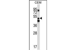 Western blot analysis in CEM cell line lysates (35ug/lane). (XPNPEP3 抗体  (C-Term))