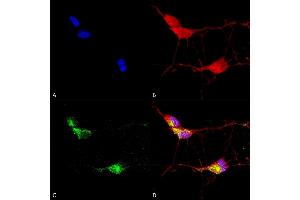 Immunocytochemistry/Immunofluorescence analysis using Mouse Anti-TrpV3 Monoclonal Antibody, Clone N15/4 (ABIN2485352). (TRPV3 抗体  (AA 774-791) (Atto 488))