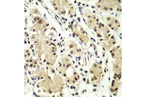 Immunohistochemistry of paraffin-embedded human gastric using ZNF264 antibody at dilution of 1:100 (x400 lens). (ZNF264 抗体)