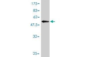 Western Blotting (WB) image for anti-TP53 Regulating Kinase (TP53RK) (AA 1-253) antibody (ABIN566693)