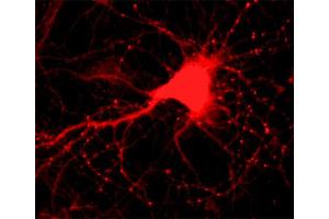 Indirect immunostaining of hippocampus neurons (dilution 1 : 500). (Alpha, beta Synuclein (AA 2-25), (N-Term) 抗体)