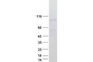 Validation with Western Blot