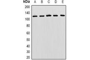 Western blot analysis of MBTPS1 expression in Hela (A), SKOV3 (B), mouse liver (C), mouse kidney (D), rat brain (E) whole cell lysates. (MBTPS1 抗体)