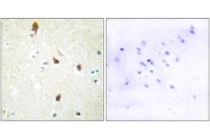 Immunohistochemistry (IHC) image for anti-Serotonin Receptor 2B (HTR2B) (AA 261-310) antibody (ABIN2889845) (Serotonin Receptor 2B 抗体  (AA 261-310))